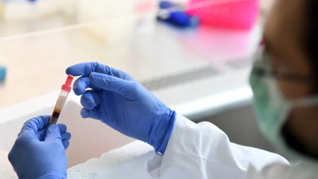 capoverde vaccino coronavirus